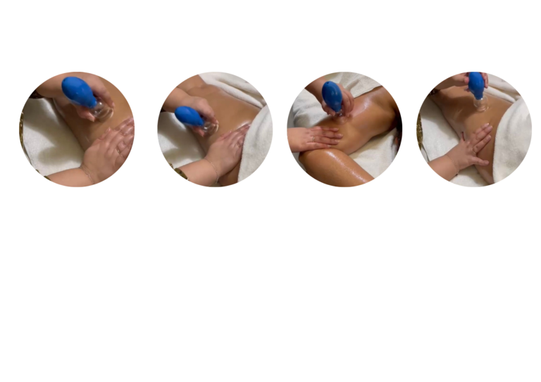 Cupping Zoetermeer